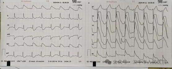 与死神赛跑  为生命接力——汉中市人民医院多部门联合救治心脏骤停